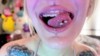 blxxdbunny - braces focused